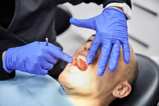 Best Tooth Infection Emergency Dentist  in Nooksack, WA